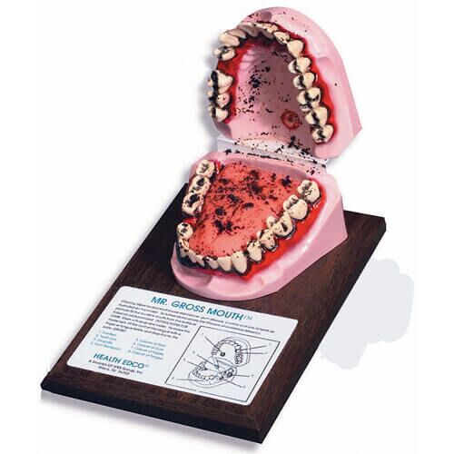 Mr. Gross Mouth Display Mr. Gross Mouth Display