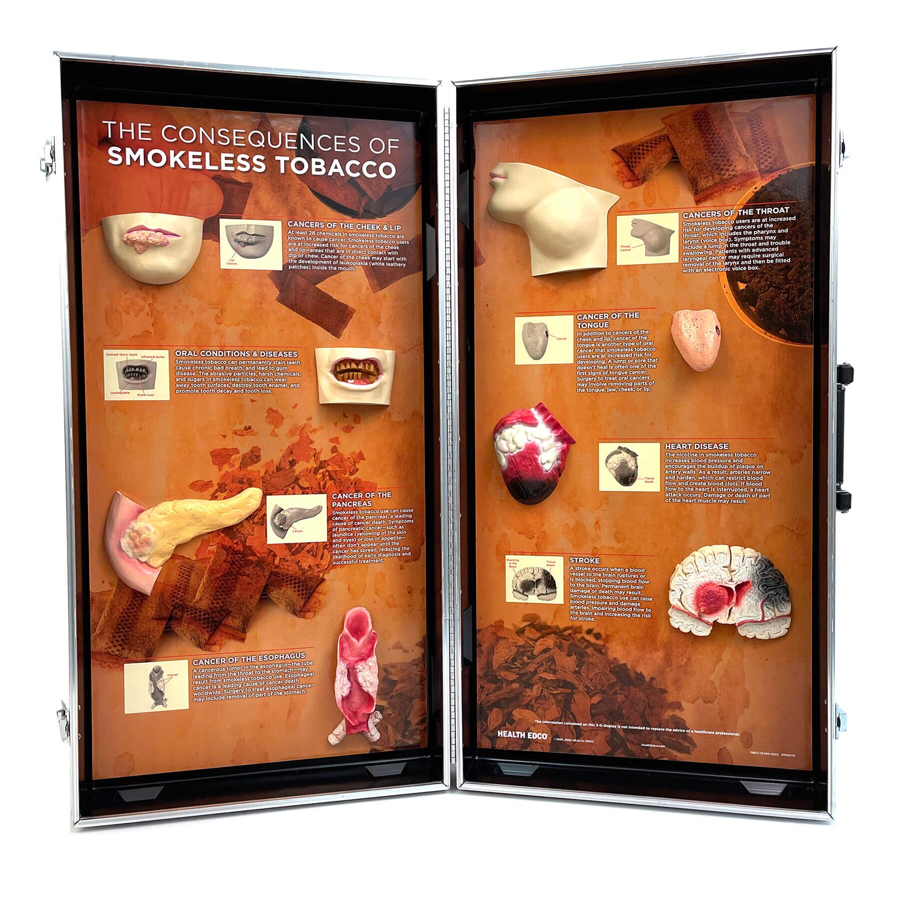 Smokeless Tobacco Consequences 3-D Display Smokeless Tobacco Consequences 3-D Display